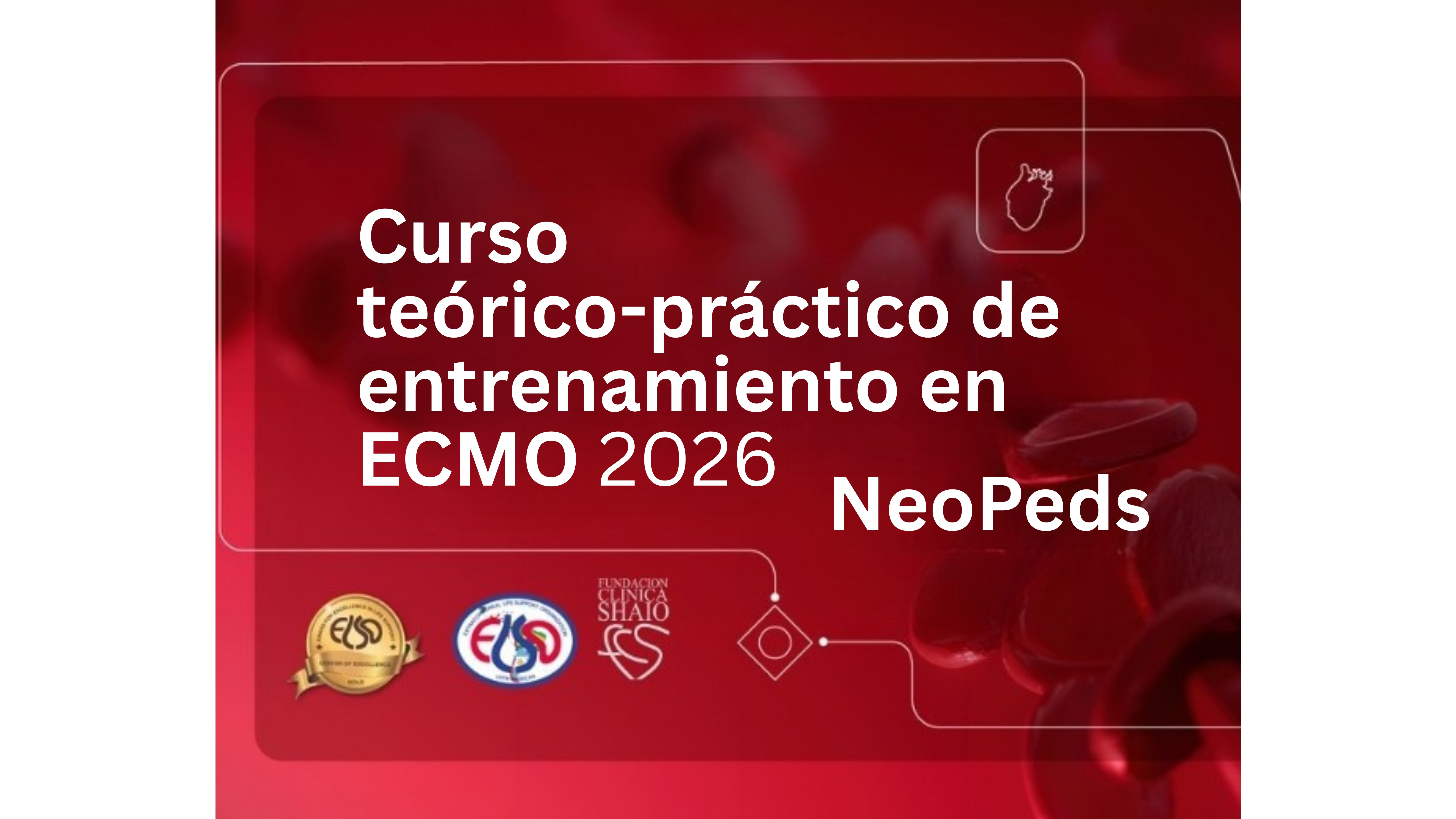 ECMO
